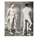 Francesco Lentini – The Three- Legged Man